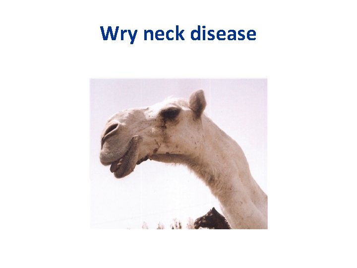 Wry neck disease 