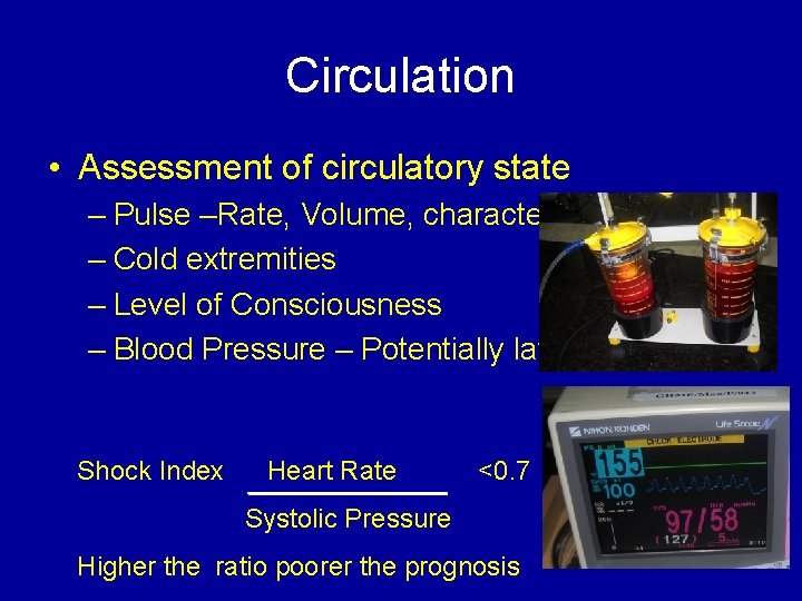 Circulation • Assessment of circulatory state – Pulse –Rate, Volume, character, – Cold extremities