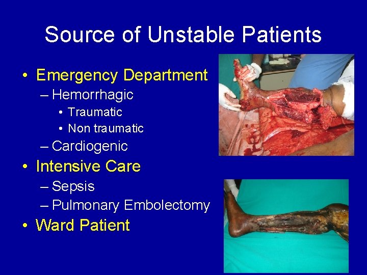 Source of Unstable Patients • Emergency Department – Hemorrhagic • Traumatic • Non traumatic