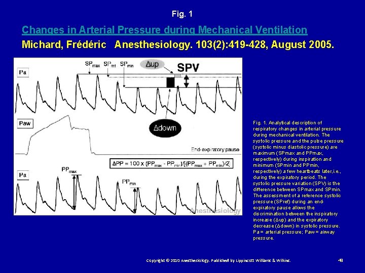 Fig. 1 Changes in Arterial Pressure during Mechanical Ventilation Michard, Frédéric Anesthesiology. 103(2): 419
