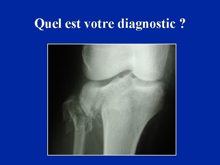 Quel est votre diagnostic ? 