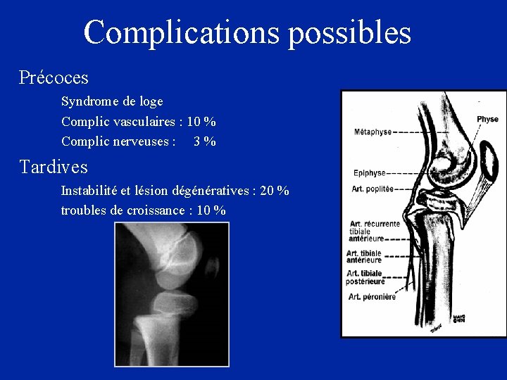 Complications possibles Précoces Syndrome de loge Complic vasculaires : 10 % Complic nerveuses :