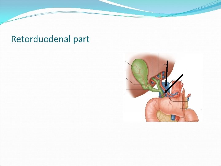 Retorduodenal part 