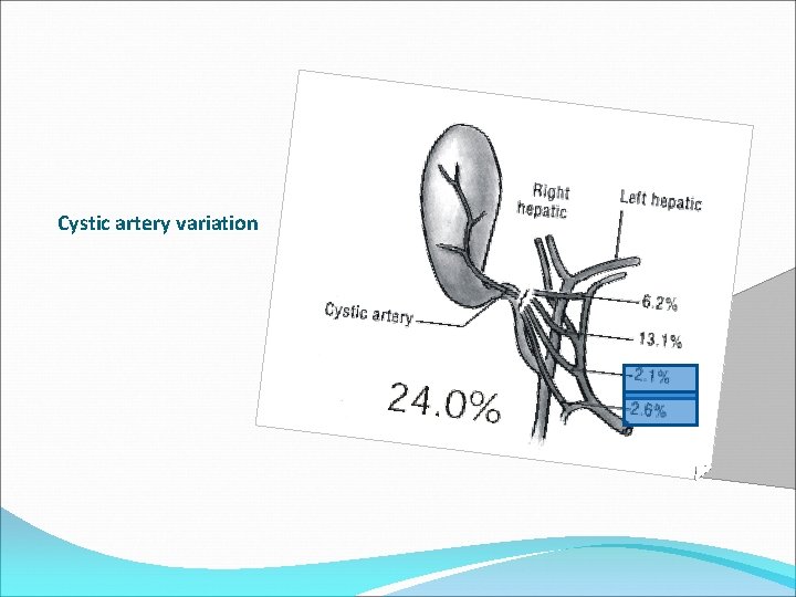 Cystic artery variation 