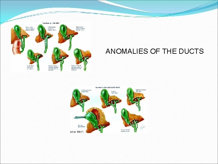 ANOMALIES OF THE DUCTS 