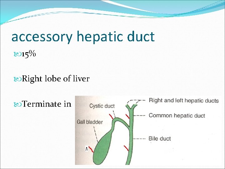 accessory hepatic duct 15% Right lobe of liver Terminate in 