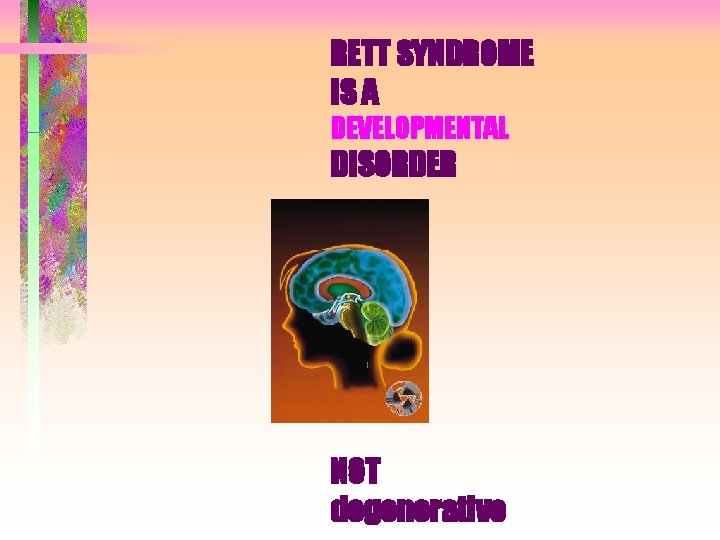 RETT SYNDROME IS A DEVELOPMENTAL DISORDER NOT degenerative RETT SYNDROME IS A DEVELOPMENTAL DISORDER NOT degenerative