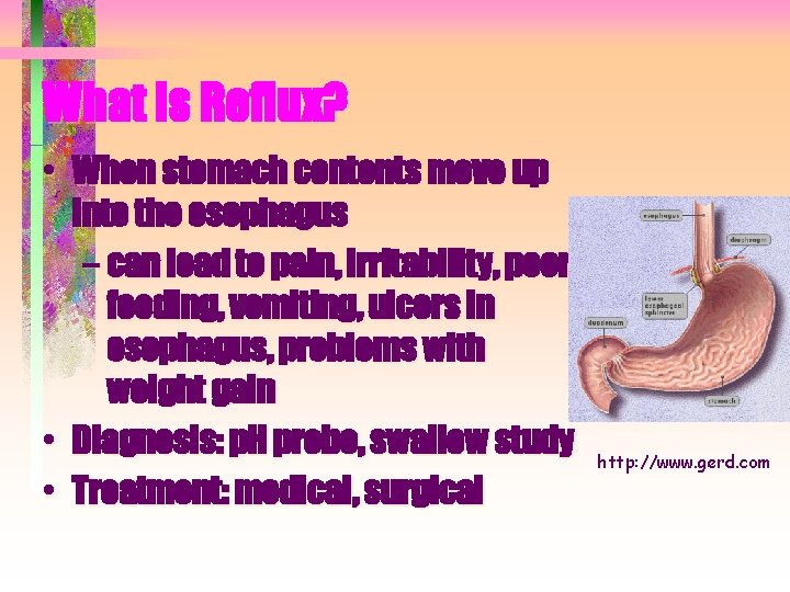 What is Reflux? • When stomach contents move up into the esophagus – can