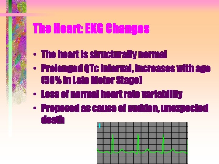 The Heart: EKG Changes • The heart is structurally normal • Prolonged QTc interval, The Heart: EKG Changes • The heart is structurally normal • Prolonged QTc interval,