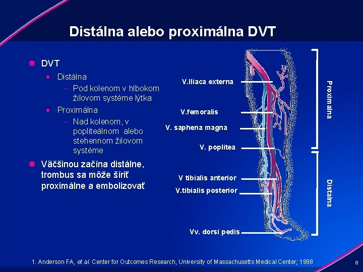 Distálna alebo proximálna DVT ® DVT V tibialis anterior V. tibialis posterior Distalna ®