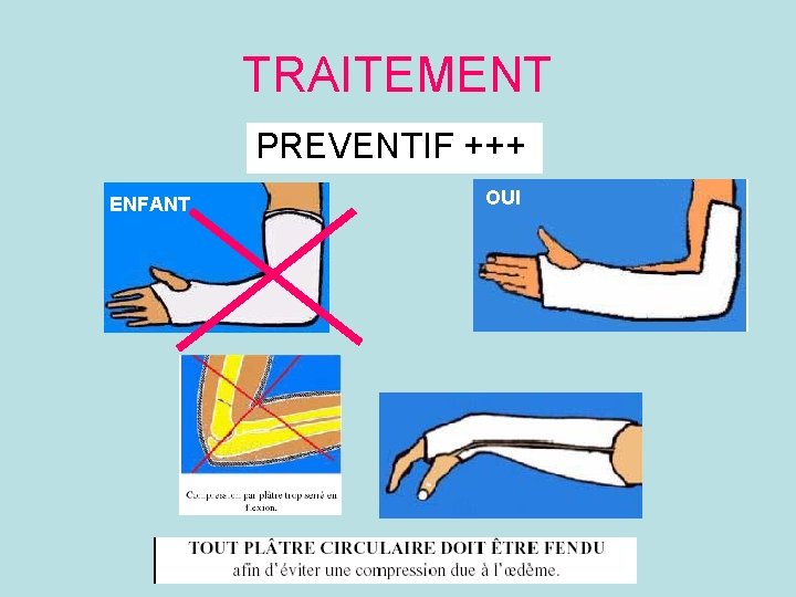 TRAITEMENT PREVENTIF +++ ENFANT OUI 