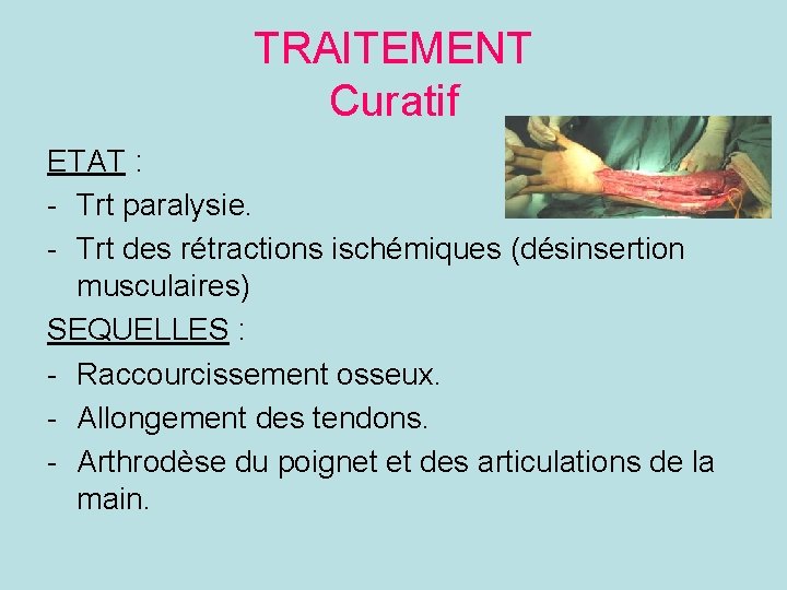 TRAITEMENT Curatif ETAT : - Trt paralysie. - Trt des rétractions ischémiques (désinsertion musculaires)