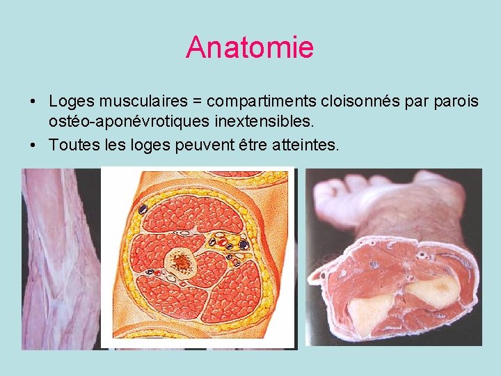 Anatomie • Loges musculaires = compartiments cloisonnés parois ostéo-aponévrotiques inextensibles. • Toutes loges peuvent