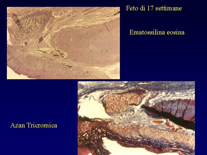 Feto di 17 settimane Ematossilina eosina Azan Tricromica 