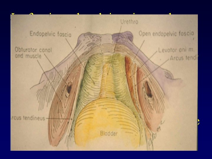 La fascia endopelvica si estende dalle pareti pelviche laterali in direzione mediale dove si