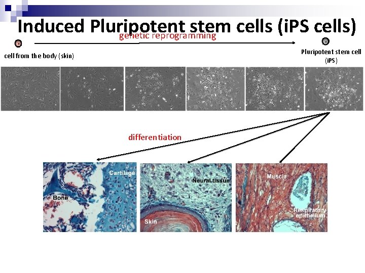 Induced Pluripotent stem cells (i. PS cells) genetic reprogramming Pluripotent stem cell (i. PS)