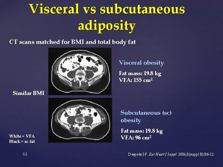 Visceral vs subcutaneous adiposity CT scans matched for BMI and total body fat Visceral