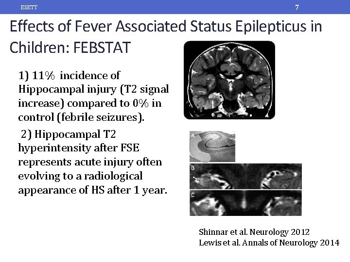 ESETT 7 Effects of Fever Associated Status Epilepticus in Children: FEBSTAT 1) 11% incidence