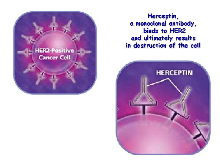 Herceptin, a monoclonal antibody, binds to HER 2 and ultimately results in destruction of