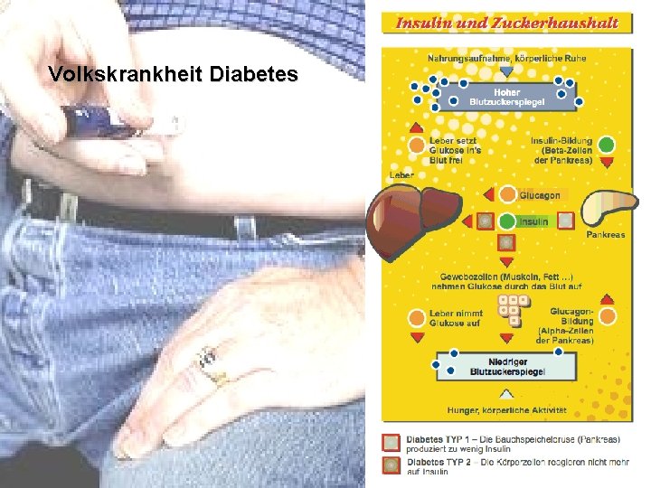 Volkskrankheit Diabetes 