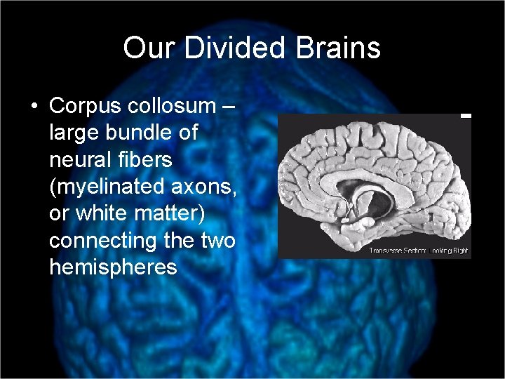 Our Divided Brains • Corpus collosum – large bundle of neural fibers (myelinated axons,