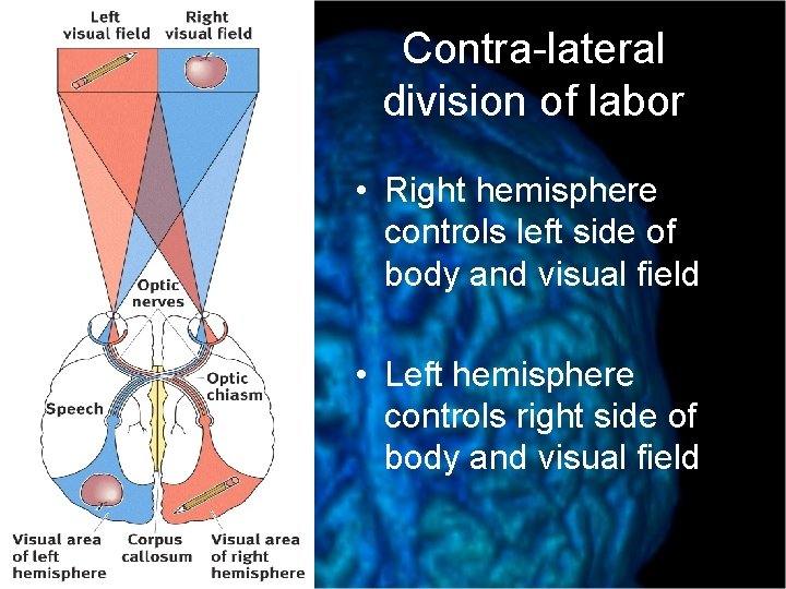 Contra-lateral division of labor • Right hemisphere controls left side of body and visual