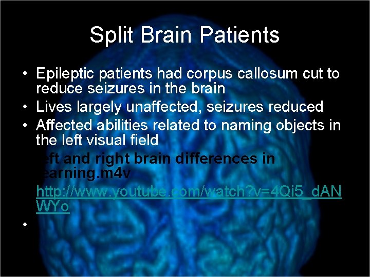 Split Brain Patients • Epileptic patients had corpus callosum cut to reduce seizures in