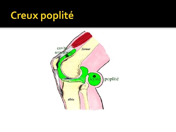Creux poplité 