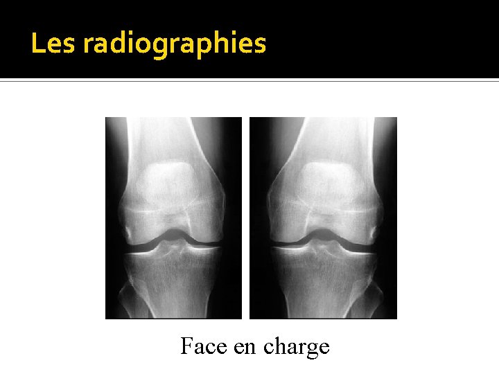 Les radiographies Face en charge 