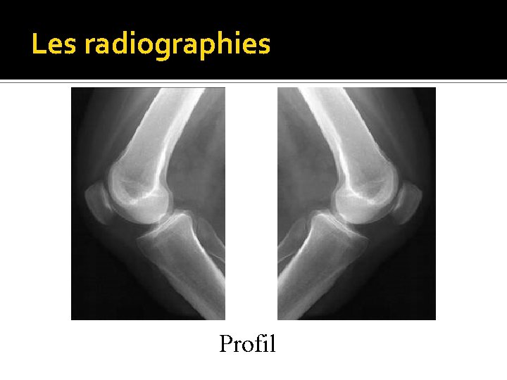 Les radiographies Profil 
