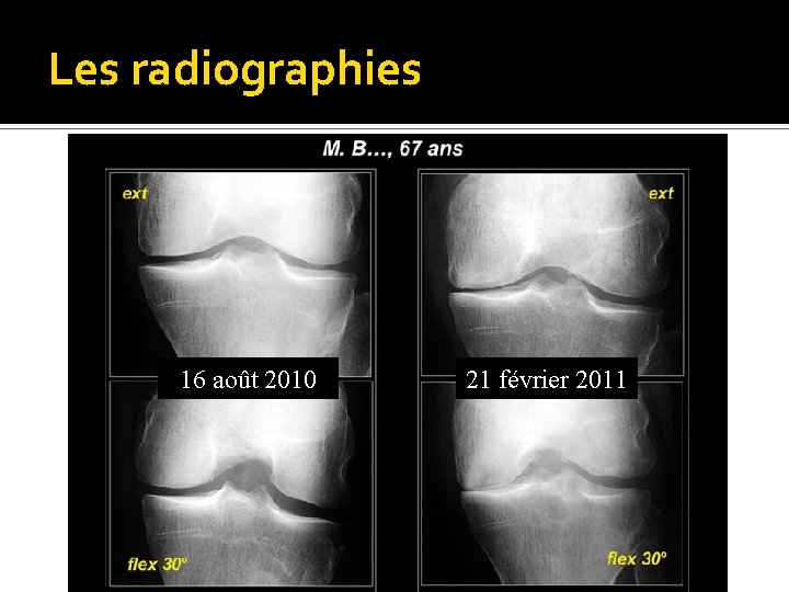 Les radiographies 16 août 2010 21 février 2011 