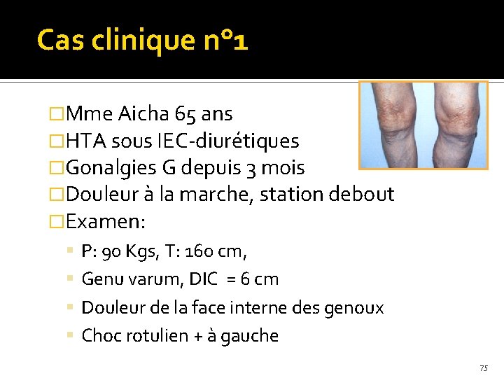 Cas clinique n° 1 �Mme Aicha 65 ans �HTA sous IEC-diurétiques �Gonalgies G depuis