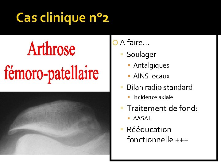 Cas clinique n° 2 A faire… Soulager ▪ Antalgiques ▪ AINS locaux Bilan radio
