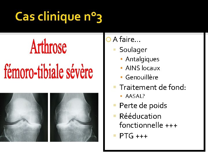 Cas clinique n° 3 A faire… Soulager ▪ Antalgiques ▪ AINS locaux ▪ Genouillère