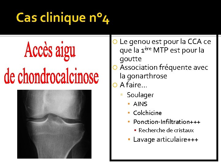 Cas clinique n° 4 Le genou est pour la CCA ce que la 1ère