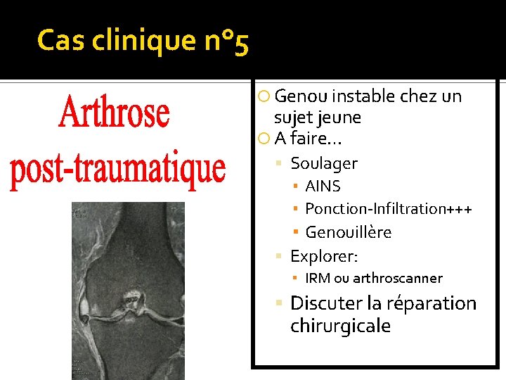 Cas clinique n° 5 Genou instable chez un sujet jeune A faire… Soulager ▪