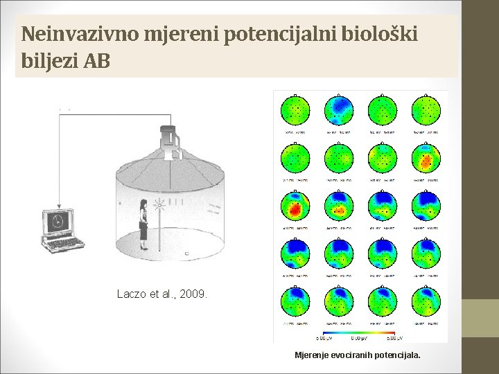 Neinvazivno mjereni potencijalni biološki biljezi AB Laczo et al. , 2009. Mjerenje evociranih potencijala.