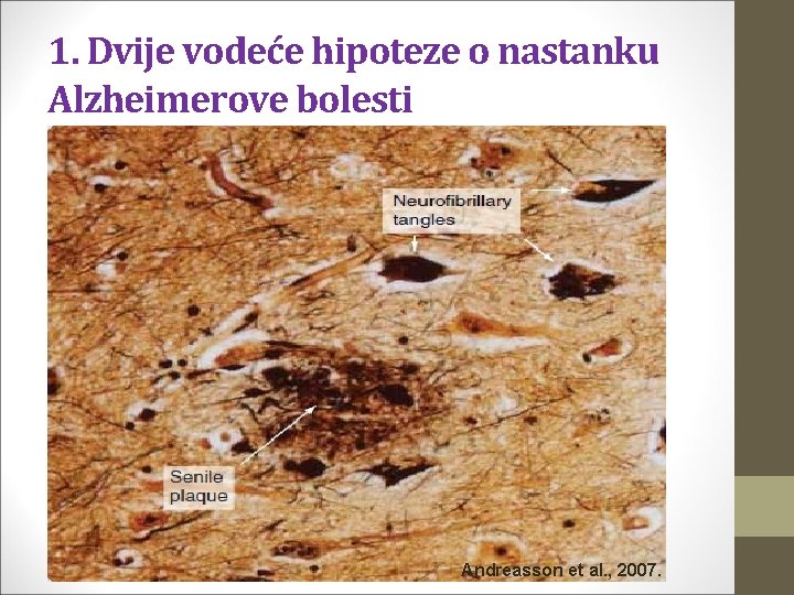 1. Dvije vodeće hipoteze o nastanku Alzheimerove bolesti Andreasson et al. , 2007. 