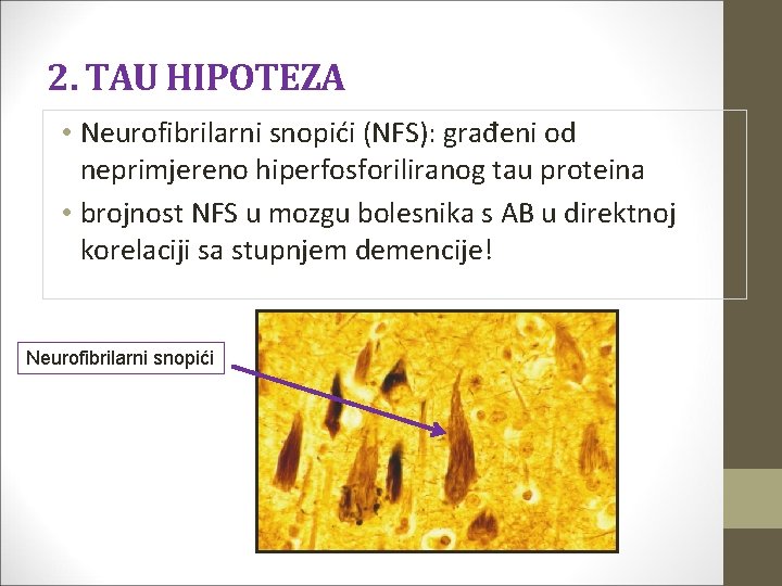  2. TAU HIPOTEZA • Neurofibrilarni snopići (NFS): građeni od neprimjereno hiperfosforiliranog tau proteina