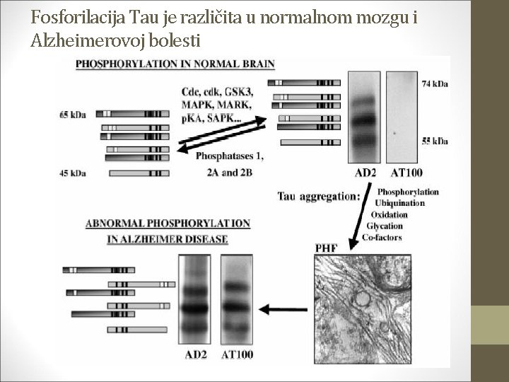 Fosforilacija Tau je različita u normalnom mozgu i Alzheimerovoj bolesti 