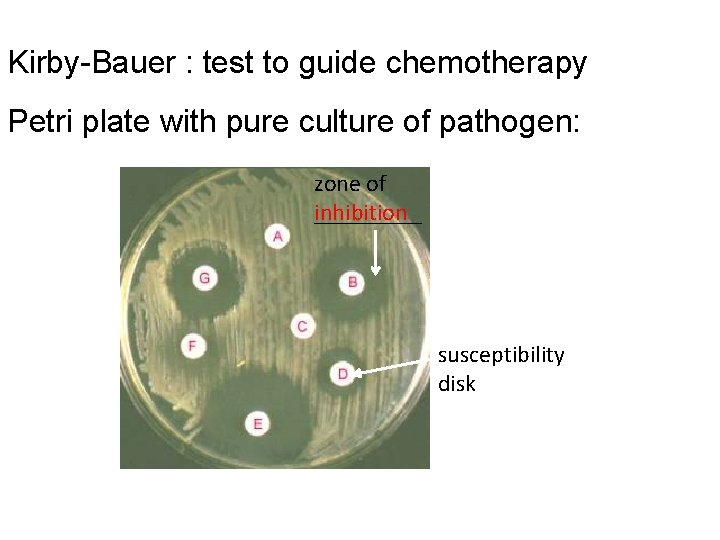 Kirby-Bauer : test to guide chemotherapy Petri plate with pure culture of pathogen: zone