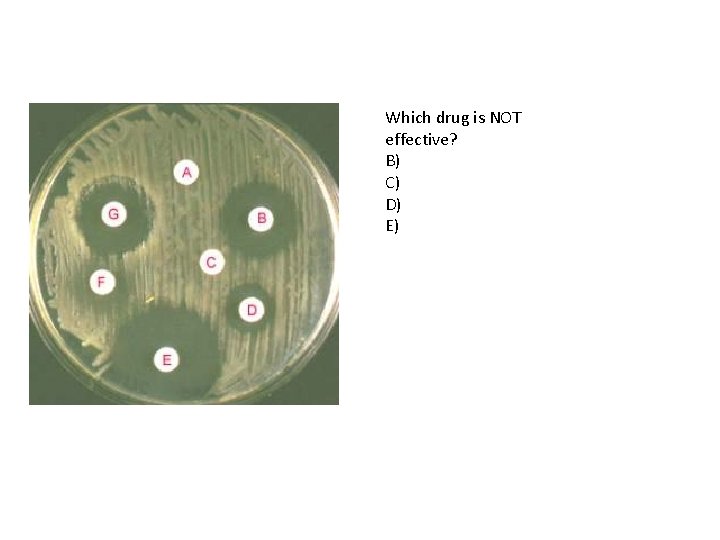 Which drug is NOT effective? B) C) D) E) 