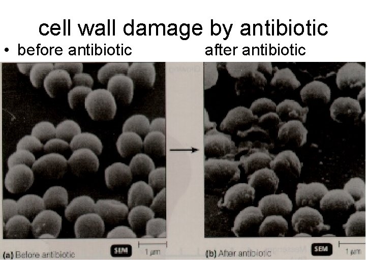 cell wall damage by antibiotic • before antibiotic after antibiotic 