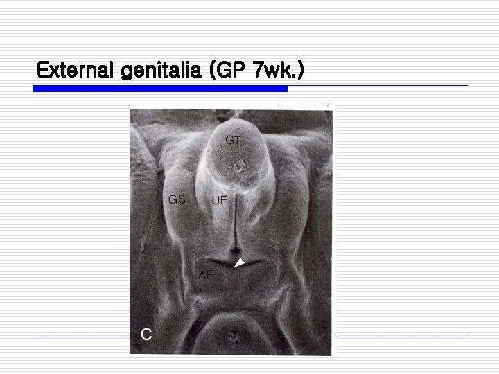 External genitalia (GP 7 wk. ) 