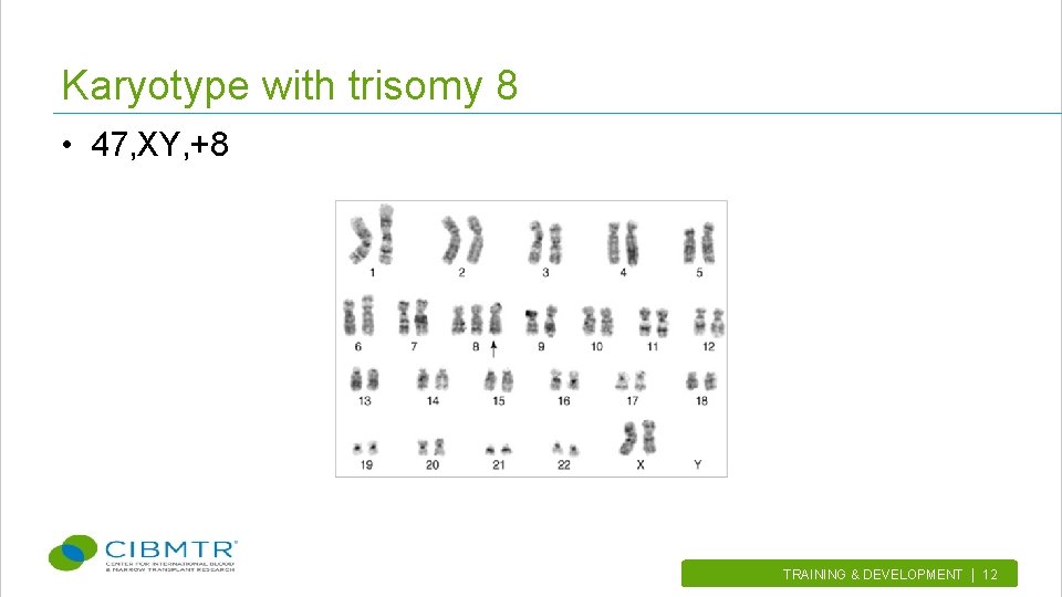Karyotype with trisomy 8 • 47, XY, +8 TRAINING & DEVELOPMENT | 12. 