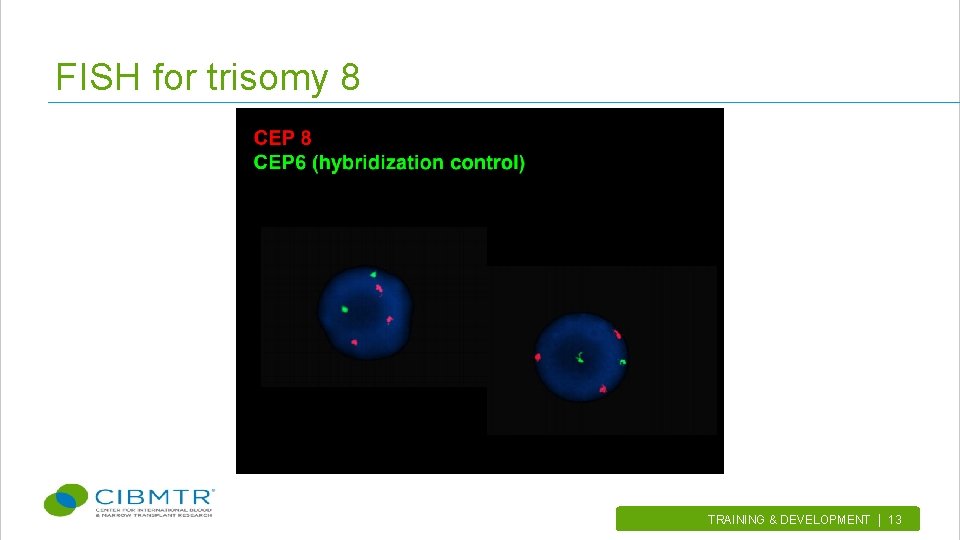 FISH for trisomy 8 TRAINING & DEVELOPMENT | 13. 