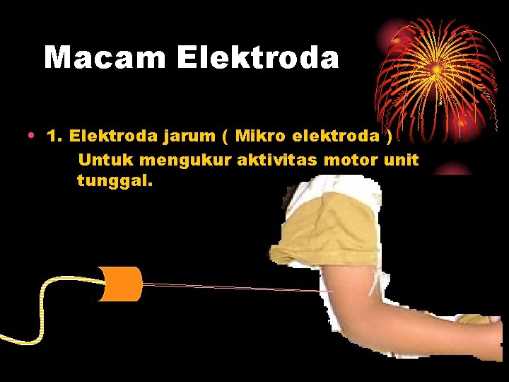 Macam Elektroda • 1. Elektroda jarum ( Mikro elektroda ) Untuk mengukur aktivitas motor