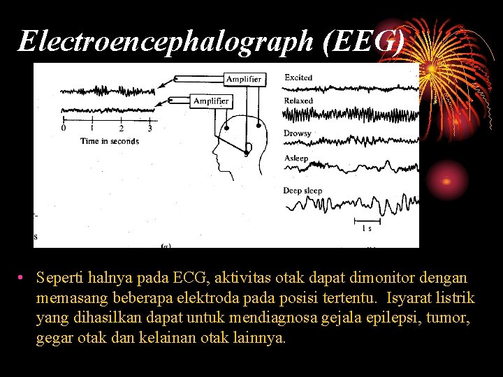 Electroencephalograph (EEG) • Seperti halnya pada ECG, aktivitas otak dapat dimonitor dengan memasang beberapa