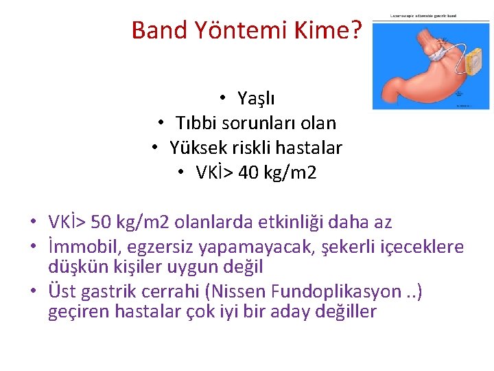 Band Yöntemi Kime? • Yaşlı • Tıbbi sorunları olan • Yüksek riskli hastalar •