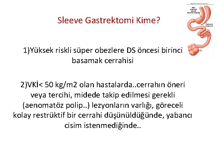 Sleeve Gastrektomi Kime? 1)Yüksek riskli süper obezlere DS öncesi birinci basamak cerrahisi 2)VKİ< 50